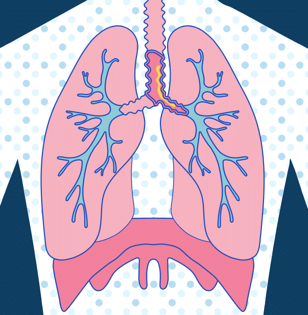 Wissenswertes Bronchialsekret | PhysioAssist